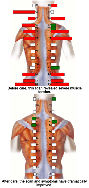 Spine Alignment, Digital Scan, Carrick Chiropractic